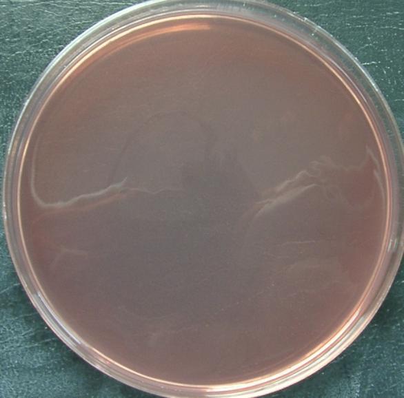 Fot.7 Escherichia