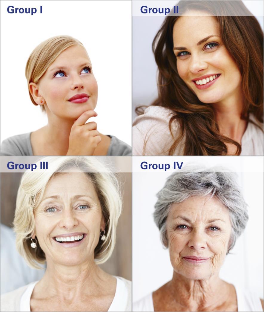 Klasyfikacja zmarszczek Oparta na postępującym starzeniu się skóry(glogau) Grupa I: Delikatne starzenie się skóry; brak zmarszczek, gładka, równa skóra Grupa II: Średnie starzenie się skóry;