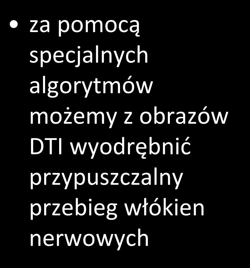 z obrazów DTI wyodrębnić