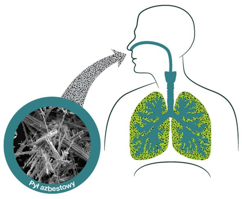 Ryc. 2. Wchłanianie włókien azbestu przez drogi oddechowe. Źródło: http://www.polskabezazbestu.