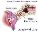 i słyszalności sygnałów ostrzegawczych decyduje