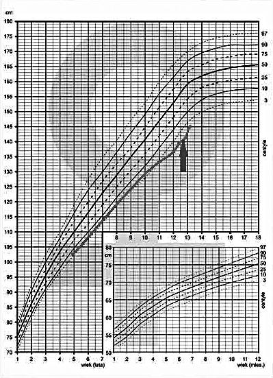 Współistnienie dwóch niezależnych jednostek chorobowych choroby... The coexistence of two independent disease units Graves disease and growth... Pediatr Endocrinol Diabetes Metab 2016;22,4:175-180 Ryc.