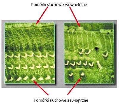 Błona podstawna w miarę oddalania się od początku ślimaka jej szerokość jest coraz większa, a twardość zwiększa się nawet o 100 razy, najważniejsze