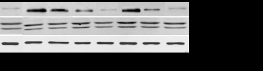 1 µm rozuwastatyny). Zarówno atorwastatyna jak i rozuwastatyna w najniższych dawkach nie miały wpływu na ekspresję TF (Rycina 20). Rycina 20.