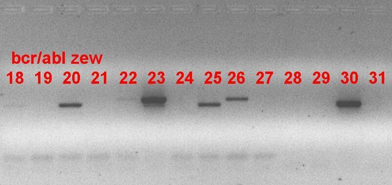 RT-PCR