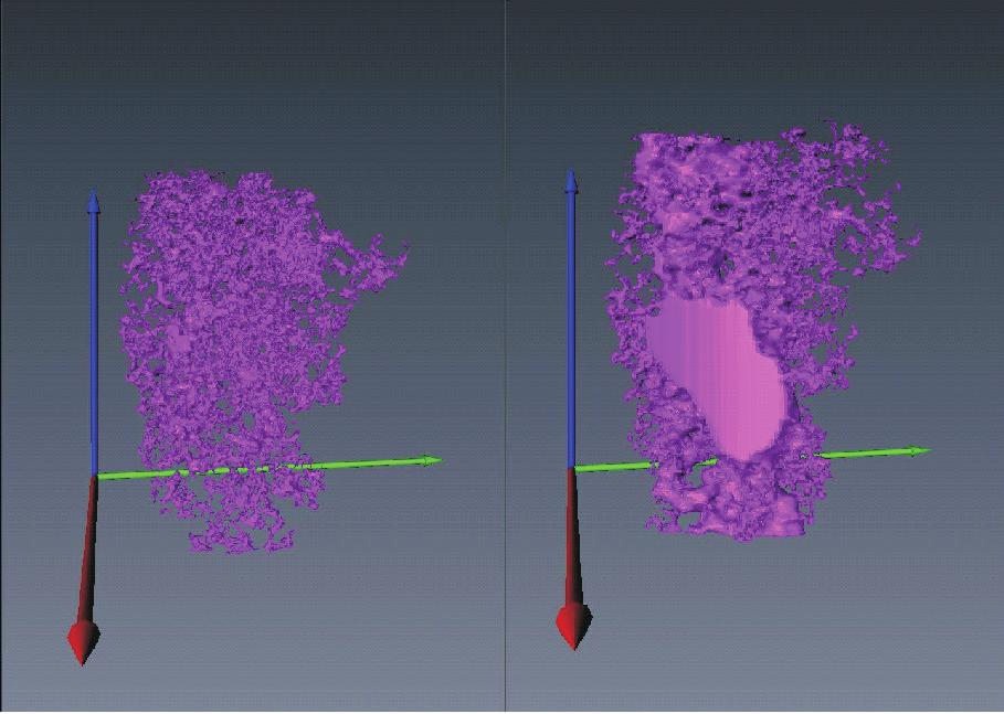 micro-ct prowadzona była przy zastosowaniu programu MAVI.