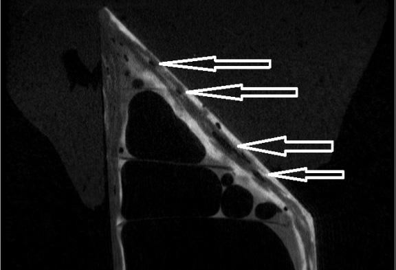 Identyfikacja nieci¹g³oœci w kompozytowych panelach sandwiczowych z wykorzystaniem mikrotomografii komputerowej 95 a) b) Rys. 3. Projekcja z mikrotomografu rtg.