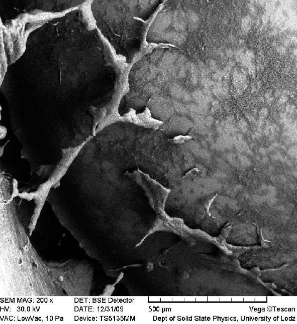 Obserwacje protez głosowych Provox w elektronowym mikroskopie skaningowym oraz analiza zdjęć dostarczyły informacji o różnicy w budowie biofilmów, utworzonych przez różne gatunki grzybów z rodzaju