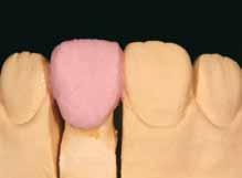 Dokładny wymiar Dentyny po kondensacji można uzyskać przez jej odcięcie.