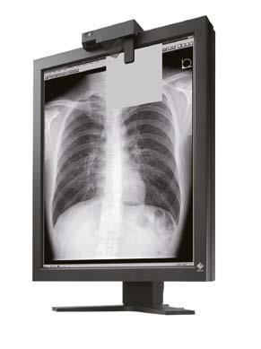 Wyświetlanie optymalnego, cyfrowego obrazu mammograficznego EIZO oferuje wszystkie komponenty konieczne