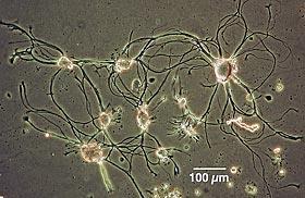 Aplysii (100µm=0.