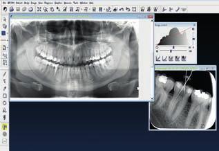 Urządzenie jest przygotowane na przyszłą współpracę z DTX Studio ** - nową platformą do diagnostyki 2D i 3D, która umożliwi integrację