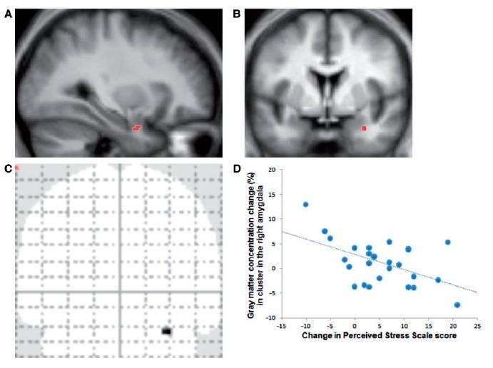 Stress reduction correlates with structural changes in
