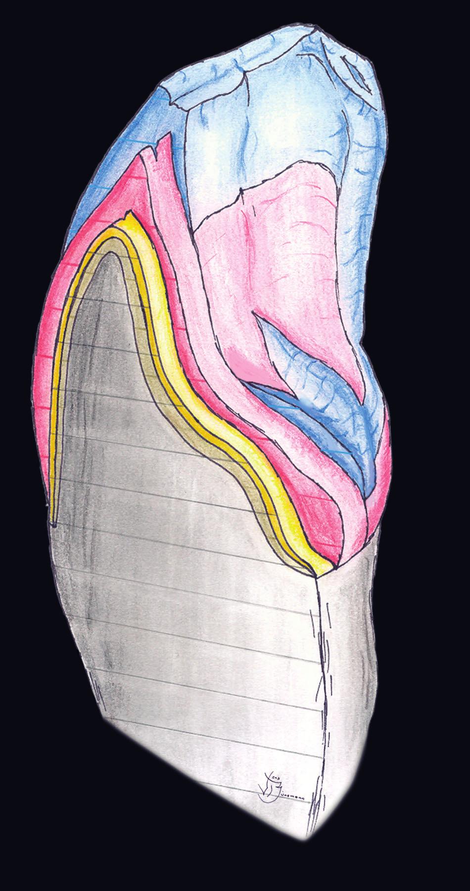 W zale noœci od rodzaju techniki warstwowej do mieszania mas nale y wybraæ pomiêdzy normalnym stabilnym p³ynem SD/SD-Color a p³ynem o wysokiej stabilnoœci SD-Form.