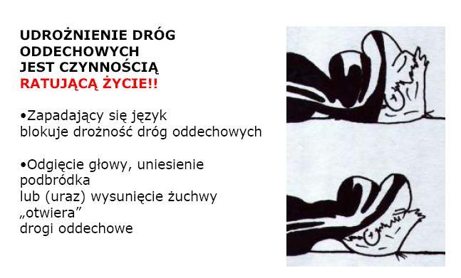 Odgięcie głowy, uniesienie podbródka lub (uraz) wysunięcie żuchwy otwiera drogi oddechowe.