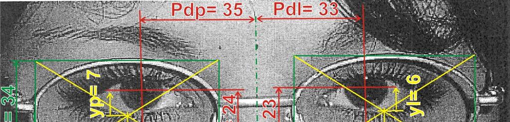 Mierzymy odległość źrenic od linii środkowej PD p = 35 mm i PD l = 33 mm Oraz wysokość połoŝenia źrenic od dołu tarczy H p = 24 mm i H l = 23 mm Obliczenia przesunięcia X P = c/2 PD P = 39-35 = 4 mm