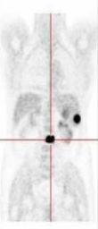 Positron Emission Tomography (PET) Używane