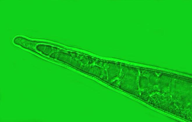 ) 1, 9, 17 marker DNA (100 bp DNA ladder, Fermentas); 2-4 Meloidogyne spp., traw.