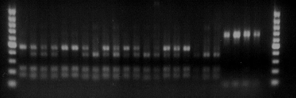 negatywna elektroforezy (fot. M. Saldat) 1 2 3 4 5 6 7 8 9 10 11 12 13 14 15 16 17 18 19 20 21 22 23 24 25 26 27 Fot. 7. Rozkład produktów RFLP w żelu agarozowym (próbka nr 2, 2011 r.