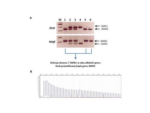 laboratorium 11-12/2013 d i a g n o s t y k a l a b o r a t o r y j n a Rys. 1. Schemat powielania fragmentu DNA klasyczną metodą PCR (A) oraz TP-PCR (B) Rys. 2.