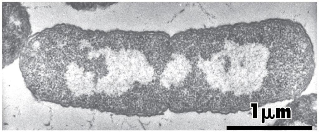 Nukleoid E.