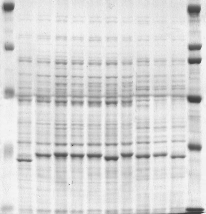 Nr 2 Antygenowe właściwości białek pałeczek Campylobacter 123 199 kda 200 kda 116 kda 116,6 kda 97,4 kda 86 kda KDa 66,2 kda 50,9 kda 50,0 kda Ryc. 1. 37,2 kda 31,0 kda 1 2 3 4 5 6 7 8 9 10 11 12 Elektroforetyczny obraz białek różnych szczepów pałeczek C.