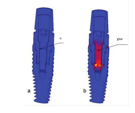 Ryc. 4. Naprężenia wstępne w implancie Xive; a model przed napięciem śruby, (h szczelina), b model po napięciu śruby (547Mpa), (glue kontakt typu klej).