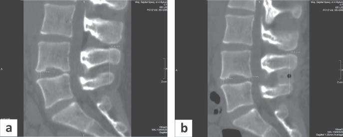 implant 2 days (48 hours) since the surgery.