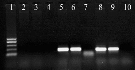 94 M. Brzychczy-Włoch i inni Nr 2 WYNIKI I ICH OMÓWIENIE Potwierdzono, że metoda PCR może być skutecznie wykorzystywana w szybkiej diagnostyce S.