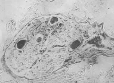Komórki zwojowe... 29 tu owalnego, czasami okrągłego lub podłuŝnego; mają kuliste jądro z ośrodkowo ułoŝonym jąderkiem oraz duŝą ilość tigroidu w cytoplazmie.