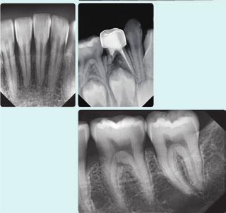 rozmiar piksela: 29,6 µm rozdzielczość teoretyczna: 17 pl/mm Oprogramowanie EzCODI posiada szeroki zakres narzędzi do wyeksponowania interesujących szczegółów.