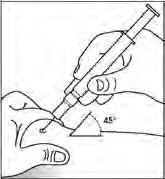 Ampułko-strzykawka bez osłony zabezpieczającej igłę 6. Cały czas trzymając skórę między palcami powoli i równomiernie naciskać tłok. 7. Po wstrzyknięciu płynu wyjąć igłę i zwolnić ucisk skóry.