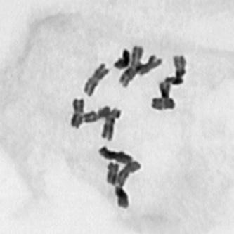 stained with acetic orceine and C-banded. a, c. from Holland, b, d. from England (scale 5 µm) które stanowiły około 3% w puli analizowanych metafaz (Ryc. 4b).