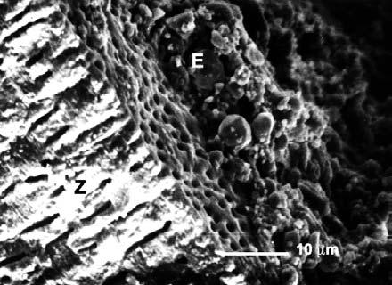 Large grains, in diameter 50 µm (arrow) Ryc. 6. Ząb wypełniony techniką kondensacji bocznej.