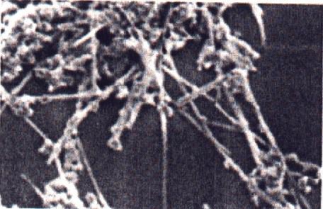 Nanomateriały a problemy zdrowotne Dotychczas jest niewiele dostępnych danych o wpływie nanocząsteczek na