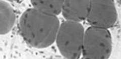 pośrednich obwodowa warstwa cytoplazmy z jądrem i organellami blaszka podstawna (!