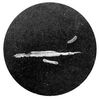 X-ray photo of the short sword hilt with visible fi