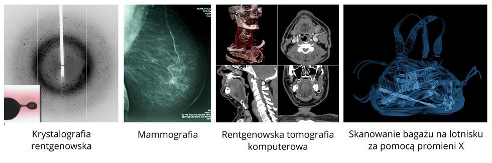 Podział fal elektromagnetycznych oraz ich zastosowanie i jest pochłaniane przez kości.