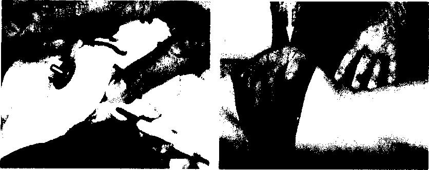 Wykonanie: Prawa dłoń unosi kość biodrową a) małymi ruchami wibracyjnymi jako gra stawowa b) w pełnym zakresie ruchu jako test ruchomości.