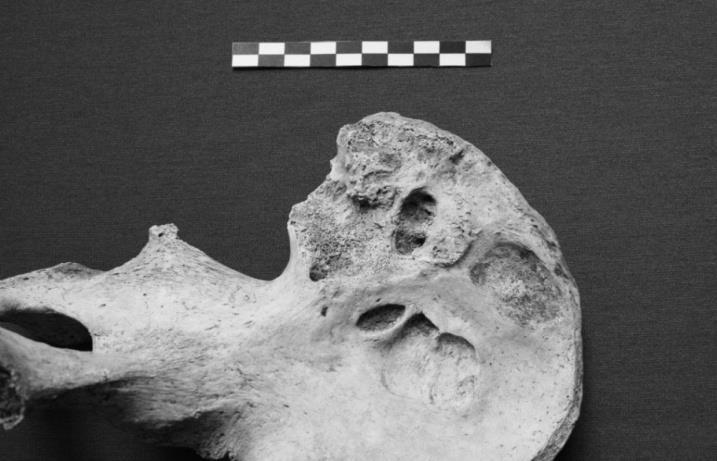 Odnotowano ich obecność w formie guzków Schmorla oraz wyrośli kostnych wzdłuż brzegów górnych i dolnych powierzchni trzonów kręgów piersiowych a także lędźwiowych osteofity (fot.3).