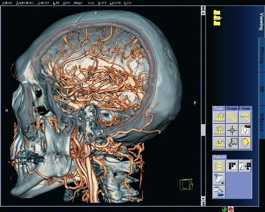 AJR 2010;194:1072-1078 Dual energy CT http://www.medical.