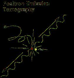 Positron Emission Tomography