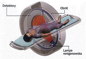 org/wiki/plik:head_ct_scan.