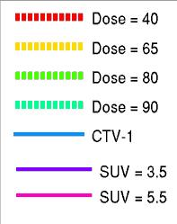 Eligible for radical treatment Register 66Gy/24 fx + CISPLATIN DAILY Dose calculation Dose escalation