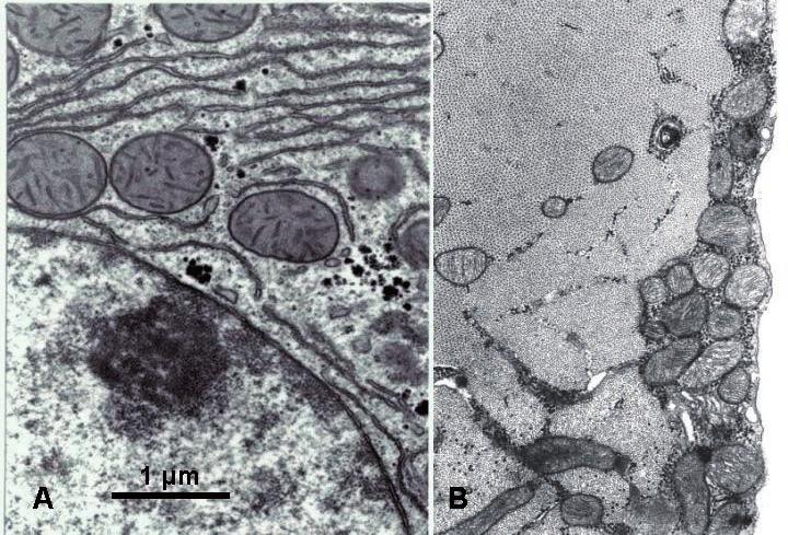 Rycina 1. Porównanie ultrastruktury mitochondriów wątroby i mięśnia. A, Wątroba szczura. Grzebienie mitochondrialne nieliczne. Ponadto widoczne są: fragment jądra i siateczka śródplazmatyczna.