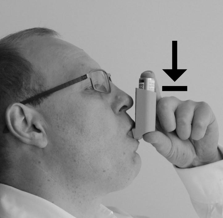 5. W momencie wykonywania wdechu przez usta nacisnąć inhalator, jak pokazano na rysunku. 6. Wyjąć inhalator z ust i spróbować wstrzymać oddech przez kilka sekund lub tak długo, jak to możliwe.