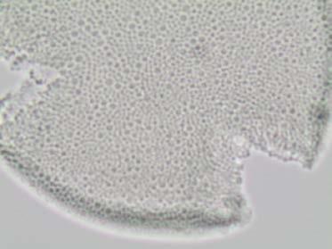 Szczegóły skulptury w obrazie mikroskopu elektronowego, widoczne zrośnięte główki wyrostków (clavae) i nieregularne bruzdy między nimi (urzeźbienie fossulate) Pollen morphology of common flax: A.