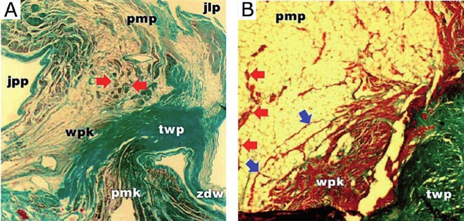 Małaczyńska-Rajpold K., Błaszyk K., Koźluk E. i wsp. Pol Przegl Kardiol. 2012;14(3): 196-203 RYCINA 4A. Strefa zwarta węzła p-k w obszarze strefy okołowęzłowej.