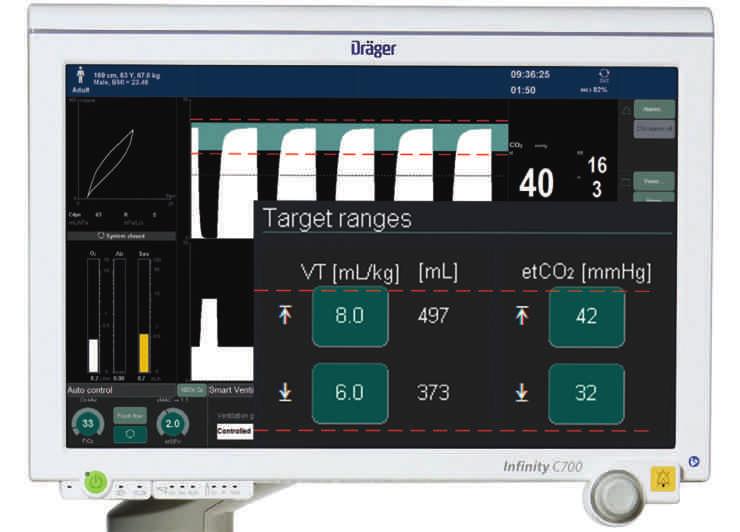 Możesz ustawiać zakresy etco2 jak linie oddzielające pasy ruchu na drodze, a SVC zagwarantuje, że wentylacja pacjentów będzie zawsze prowadzona w tych granicach.