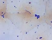 11. Structure in the central part of specimen no.